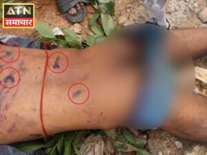रेणुकास्वामी की डेडबॉडी बेंगलुरु में एक नाले के पास मिली थी। शरीर पर पिटाई के निशान थे। आरोपियों ने उन्हें बुरी तरह पीटा था, जिससे उनकी मौत हो गई।